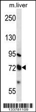 MMP17 Antibody