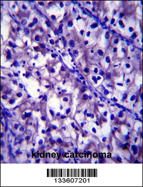 LAMB1 Antibody