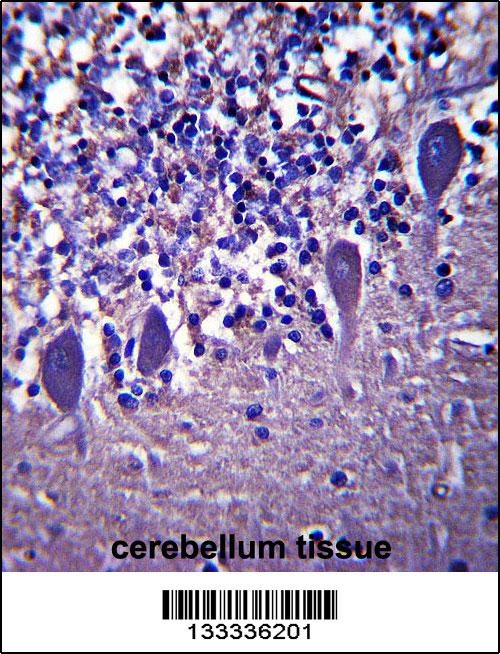 LRRC8B Antibody