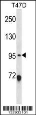 ANKS6 Antibody