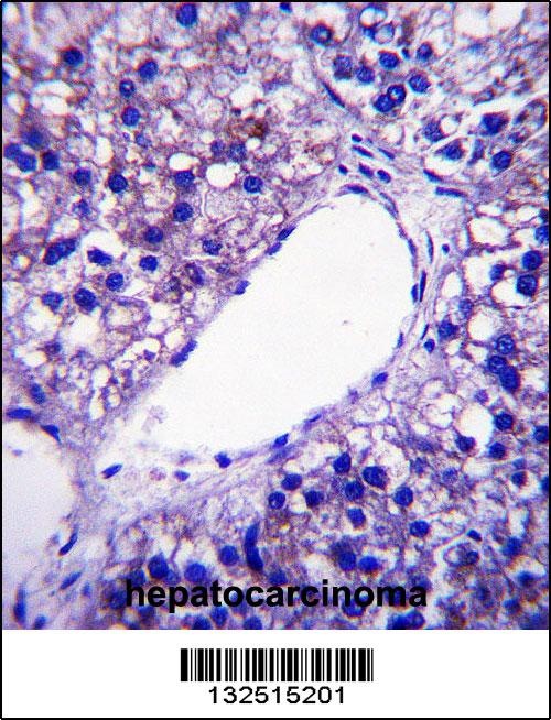 PNPLA4 Antibody