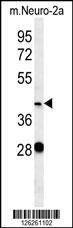 VASH2 Antibody