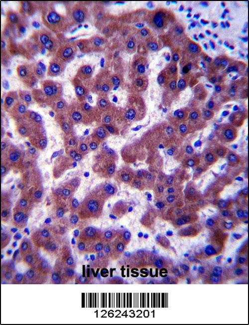 MSMO1 Antibody