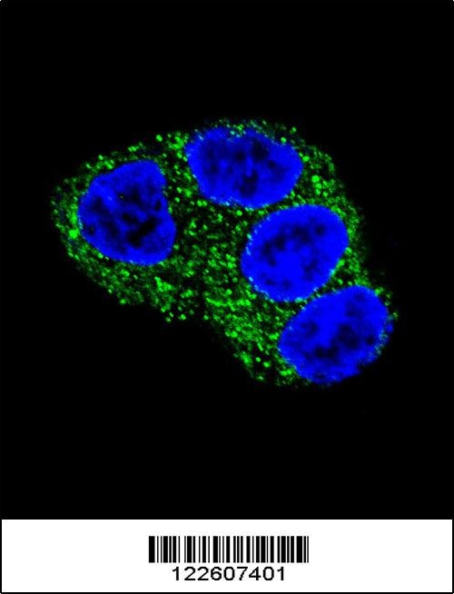 UGT1A1 Antibody