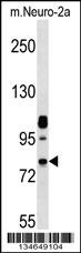 Mouse Nek8 Antibody