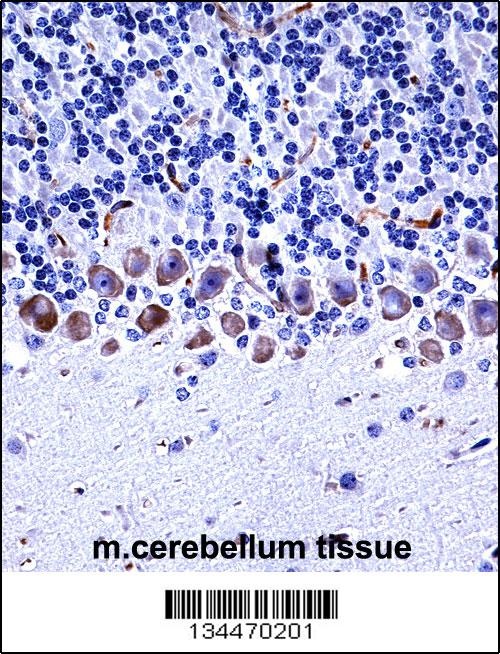 Epha4 Antibody