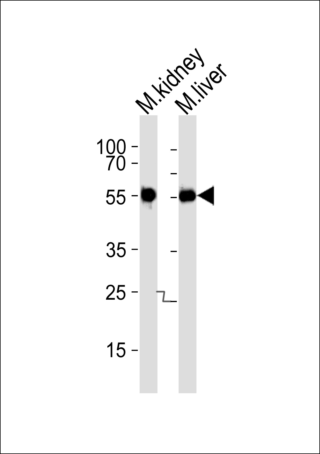 Mouse Csnk1g3 Antibody
