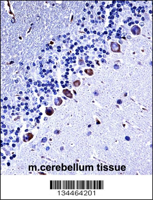 Mouse Csnk1g3 Antibody