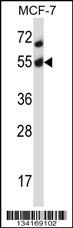 Mouse Akt2 Antibody
