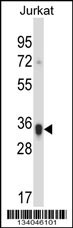 KIR2DS1 Antibody