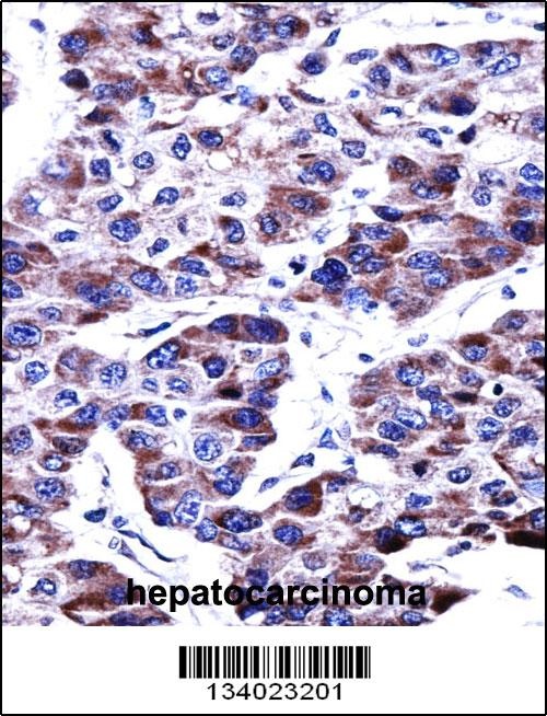 DUSP9 Antibody