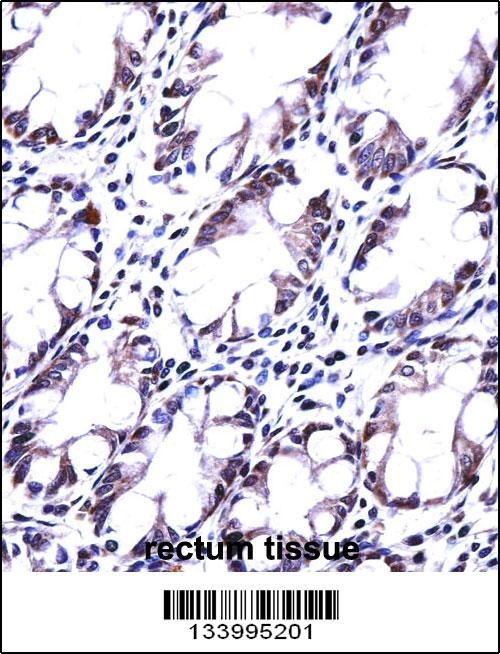 HRASLS5 Antibody