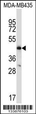 CCR9 Antibody