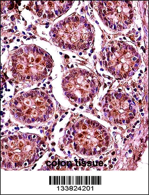 SMC1B Antibody