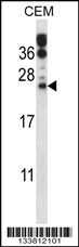 RAB6B Antibody