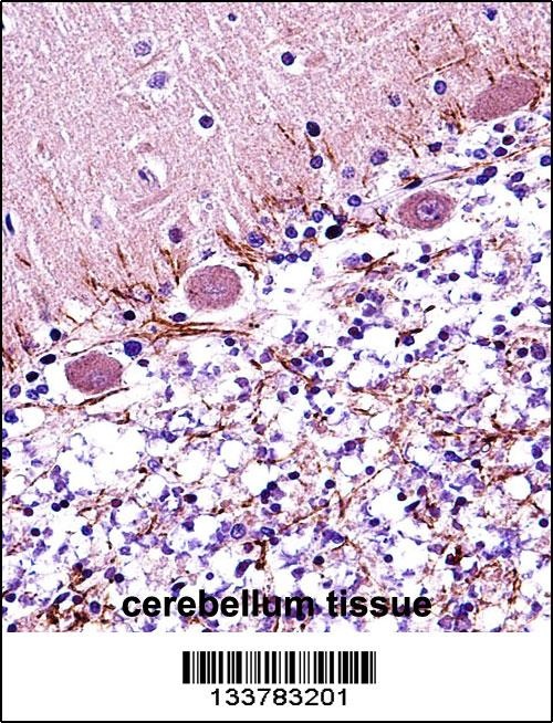 RARA Antibody