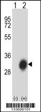 HLA-DPB1 Antibody