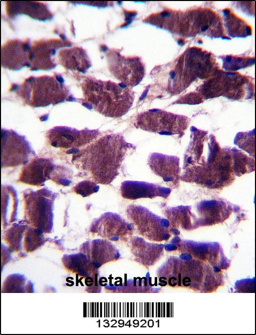 LRIG2 Antibody