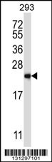 RAB1B Antibody