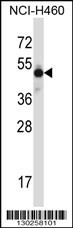 MKX Antibody
