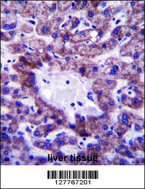 NADK2 Antibody