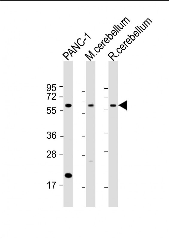 SLC11A2 Antibody