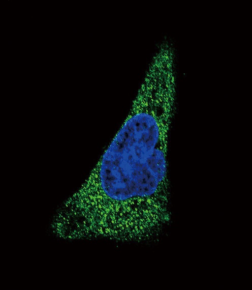 SLC11A2 Antibody