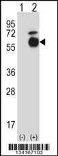 Mouse Acvr1 Antibody