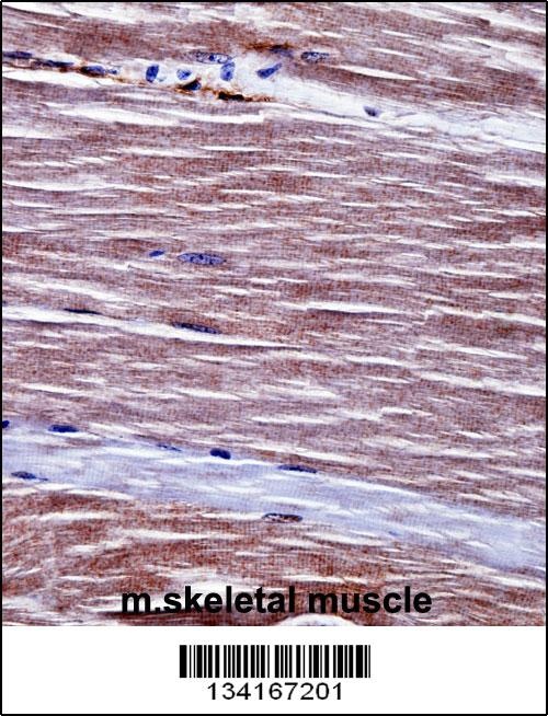 Mouse Acvr1 Antibody