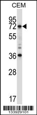 RORC Antibody