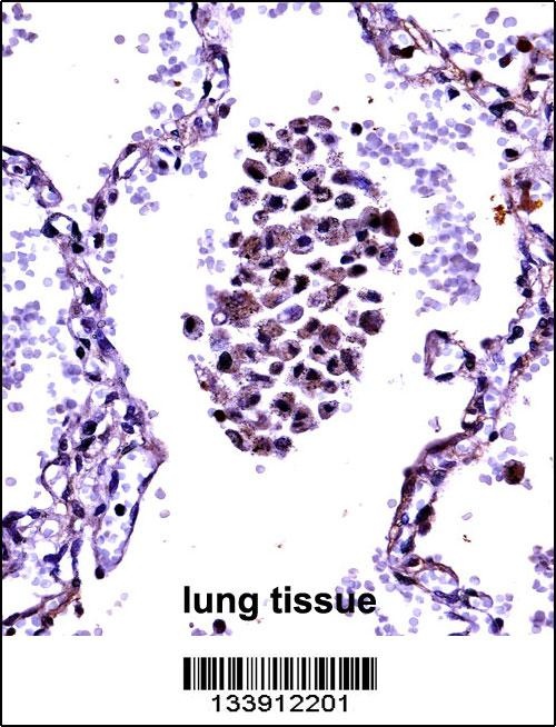 NFKBIB Antibody