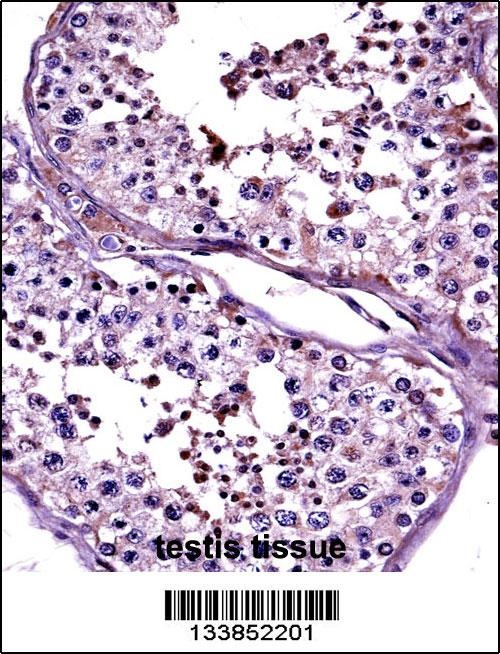 CTAG2 Antibody