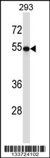 TUBB2A Antibody