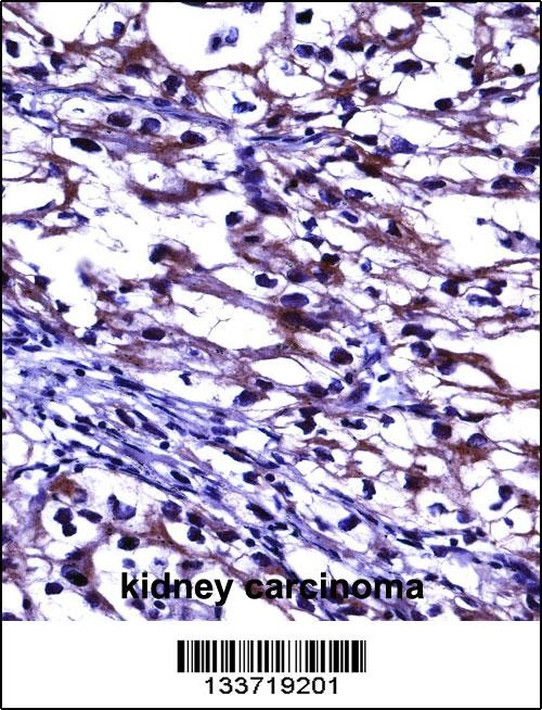 TNFRSF11B Antibody