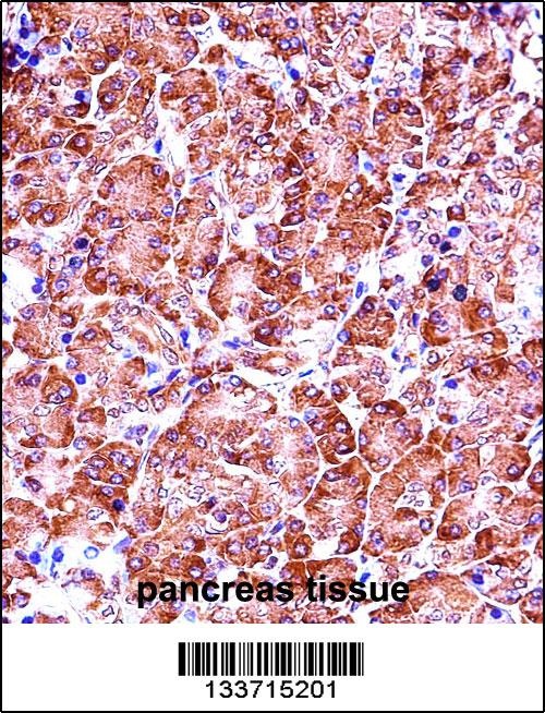 MMP28 Antibody