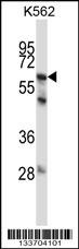 MMP11 Antibody