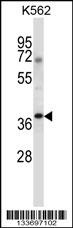 NCK1 Antibody