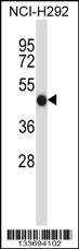 FCGR2A Antibody