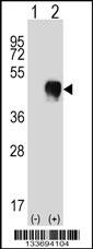 FCGR2A Antibody