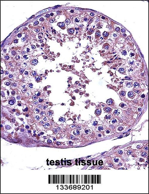 STAT4 Antibody