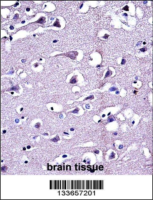 MMP16 Antibody