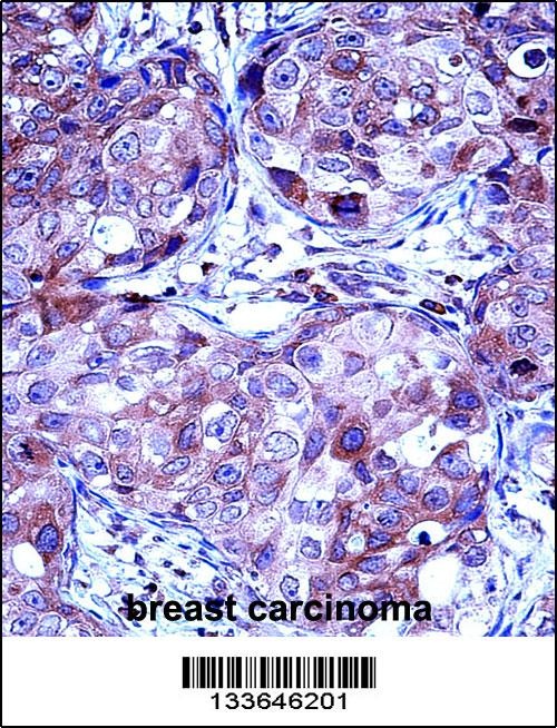 MMP13 Antibody