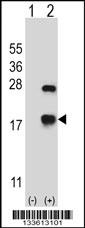 CRYAB Antibody