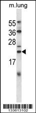 CRYAB Antibody