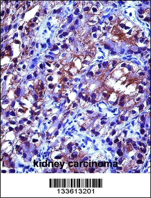 CRYAB Antibody