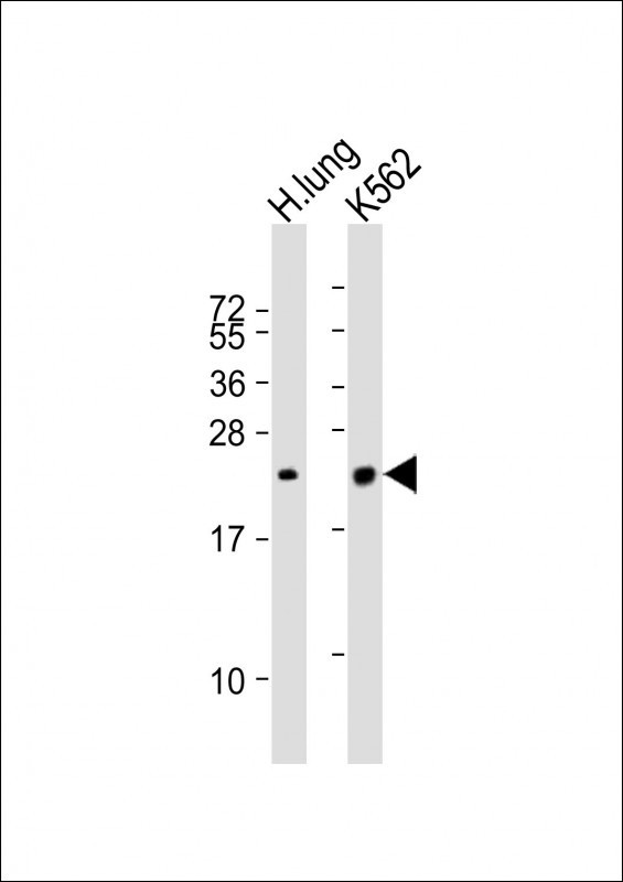 SFTPC Antibody