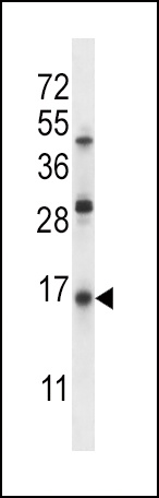 SFTPC Antibody