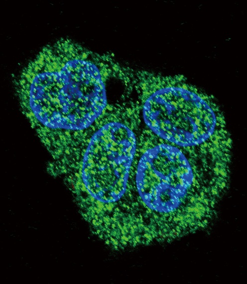 SFTPC Antibody