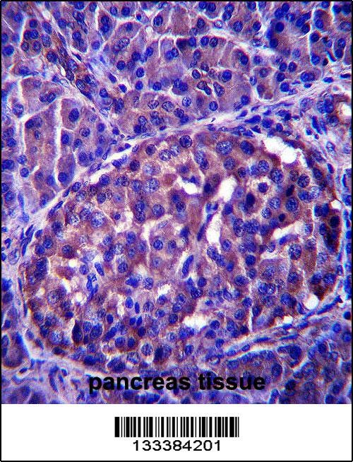 LRRN4 Antibody