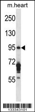 EXOC6B Antibody